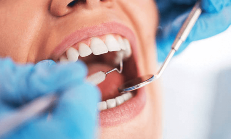 A Modern Solution for Tooth Decay: The Story Behind Composite Fillings