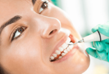 Keeping Your Smile Fresh: The Real Deal on Teeth Cleanings