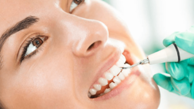 Keeping Your Smile Fresh: The Real Deal on Teeth Cleanings