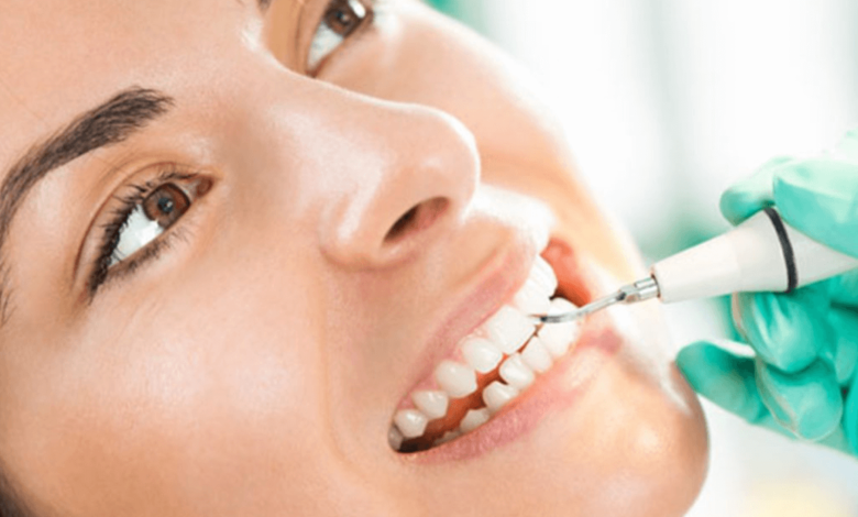 Keeping Your Smile Fresh: The Real Deal on Teeth Cleanings