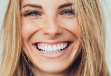 Brighten Your Smile with Professional Teeth Whitening