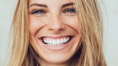 Brighten Your Smile with Professional Teeth Whitening