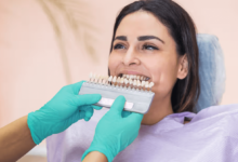 Everything You Need to Know About Dental Crowns