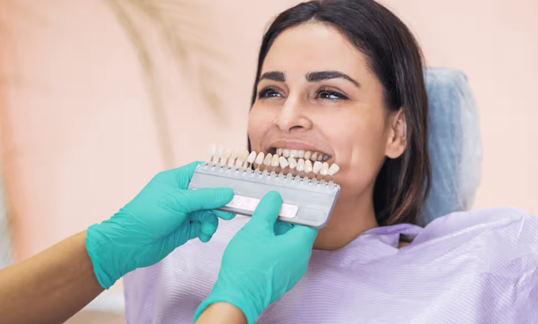 Everything You Need to Know About Dental Crowns